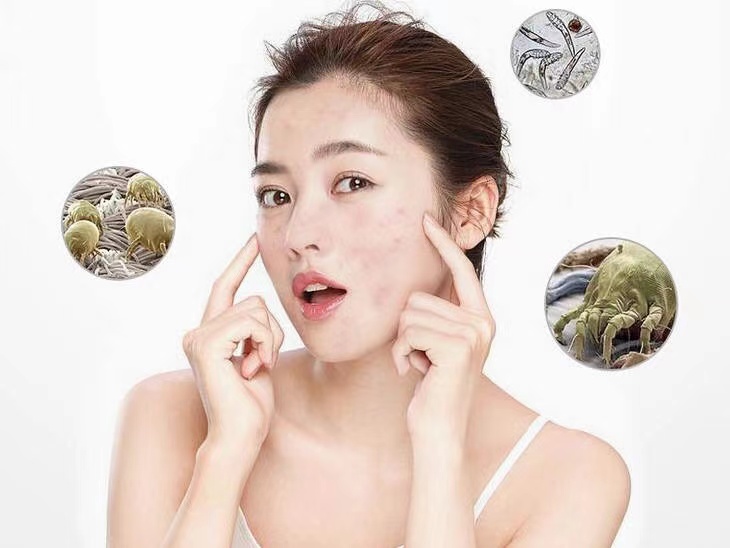 皮膚經(jīng)常過(guò)敏，長(zhǎng)痘？警惕是新房裝修原因！